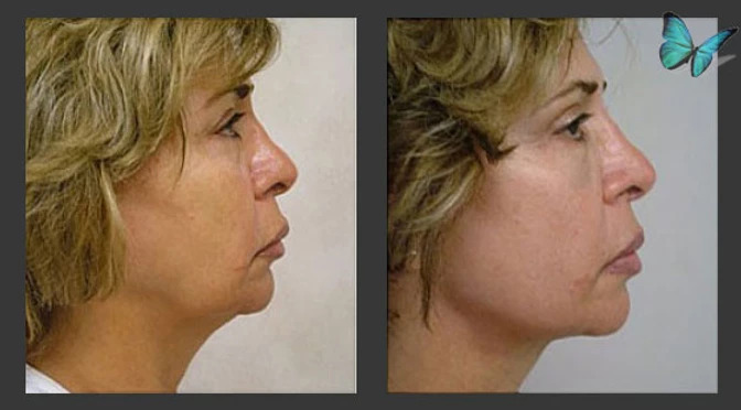 ezgif-4-2c7665487d0a