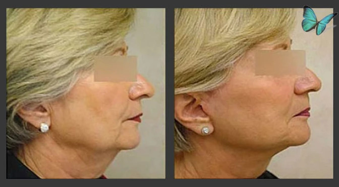 ezgif-4-ec390da6b3bd